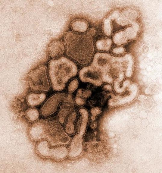 virus H1N1