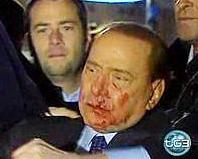 Silvio Berlusconi dopo l'aggressione
